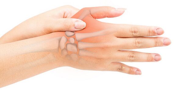 Stenozirajoči ligamentitis blokira prst v upognjenem položaju