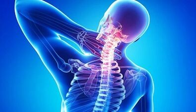 Simptomi in zdravljenje osteohondroze materničnega vratu