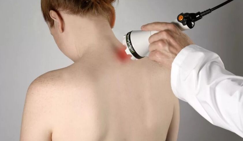 Fizioterapevtska metoda zdravljenja osteohondroze materničnega vratu