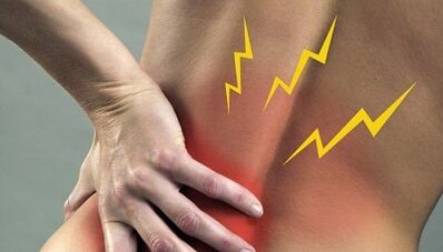 Bolečina za ledveno osteohondrozo